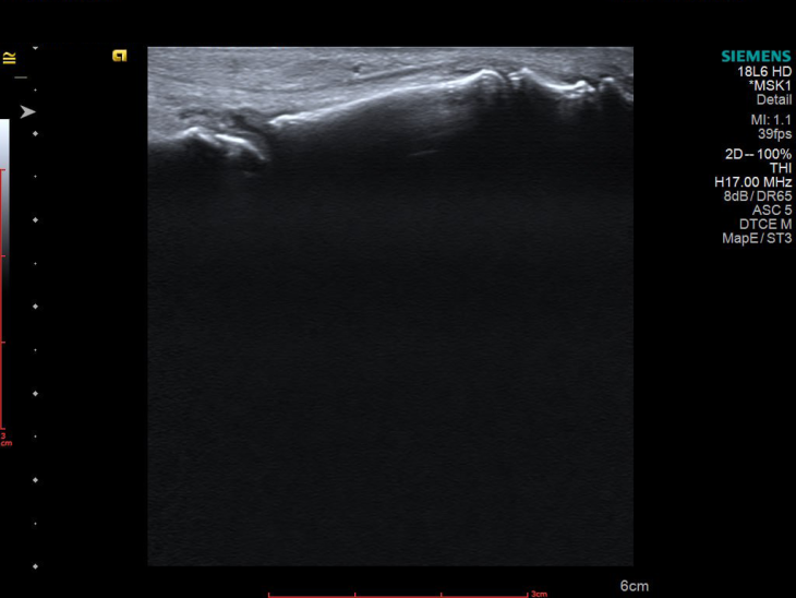 УЗД як детектив: історія про хибну подагру